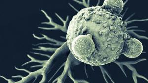 Cancer ISTOCK Cancer